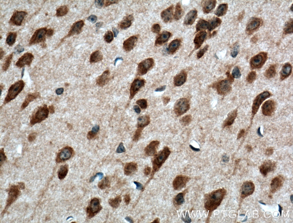 Immunohistochemistry (IHC) staining of mouse brain tissue using PELI1 Polyclonal antibody (12053-1-AP)