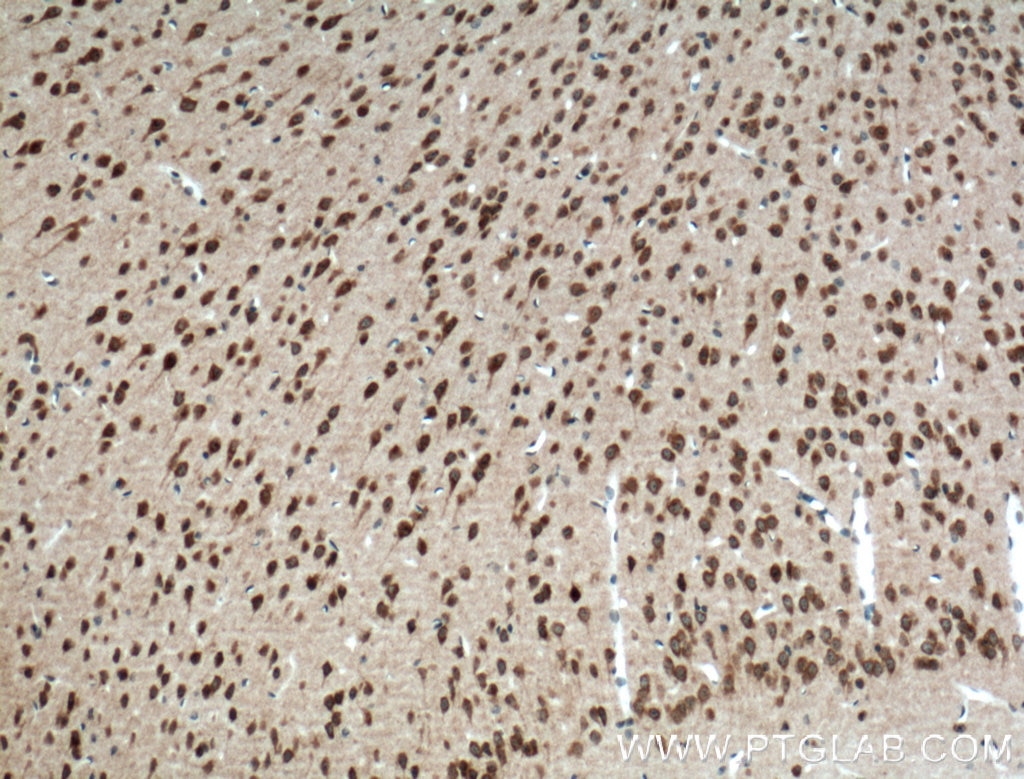 Immunohistochemistry (IHC) staining of mouse brain tissue using PELI1 Polyclonal antibody (12053-1-AP)