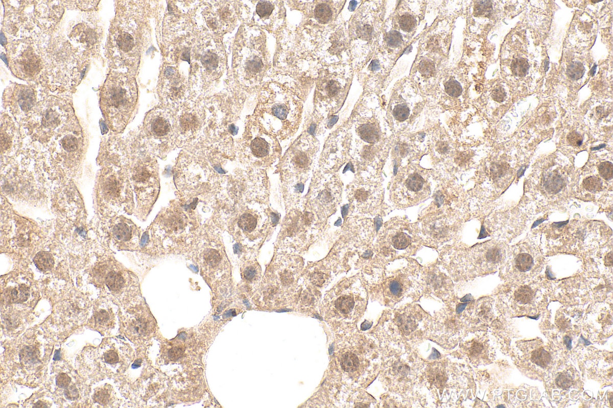 Immunohistochemistry (IHC) staining of mouse liver tissue using PELI1 Recombinant monoclonal antibody (87624-2-RR)