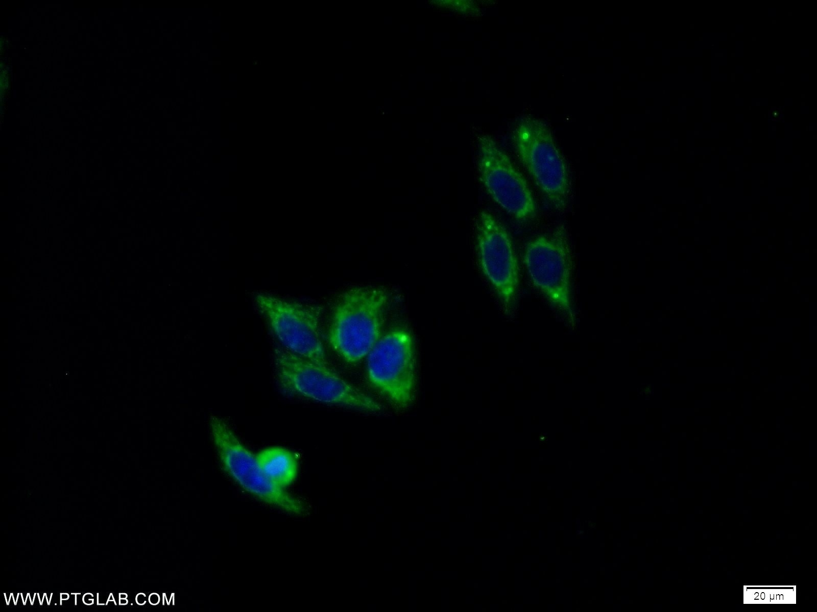 Immunofluorescence (IF) / fluorescent staining of HepG2 cells using PELI2 Polyclonal antibody (16097-1-AP)