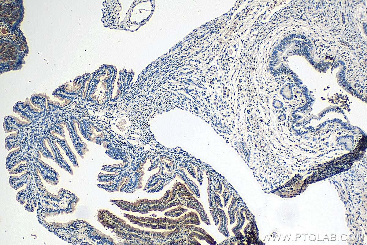 Immunohistochemistry (IHC) staining of mouse ovary tissue using PELI2 Polyclonal antibody (16097-1-AP)
