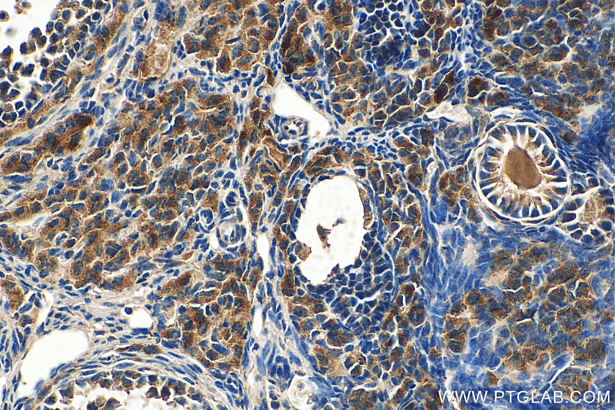 Immunohistochemistry (IHC) staining of mouse ovary tissue using PELI2 Polyclonal antibody (16097-1-AP)