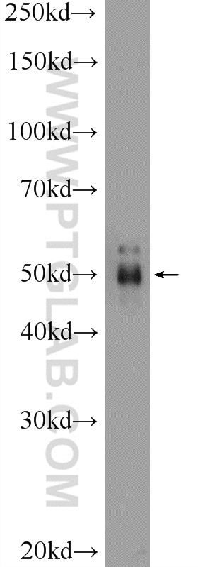 Western Blot (WB) analysis of Raji cells using PELI2 Polyclonal antibody (16097-1-AP)