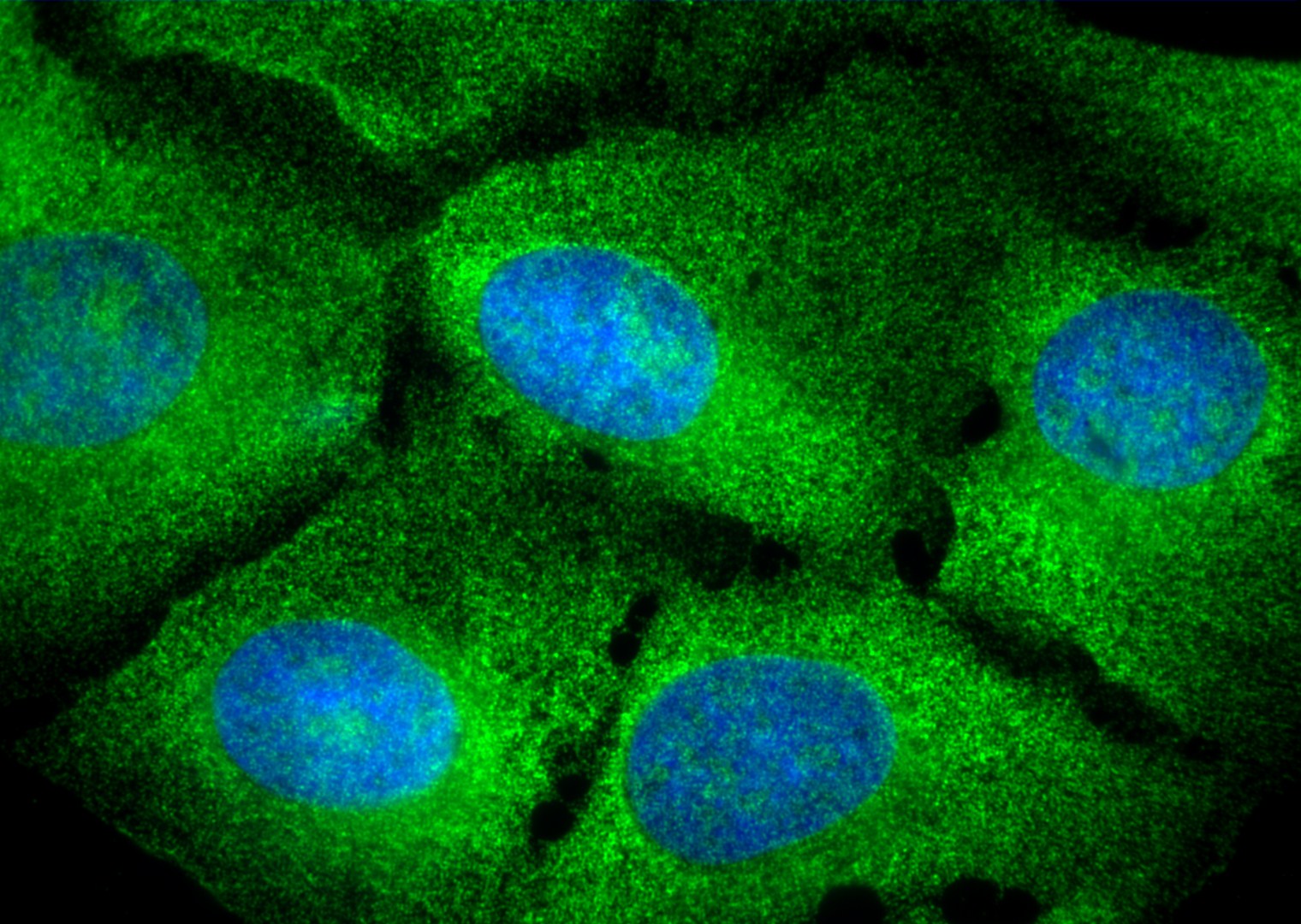 Immunofluorescence (IF) / fluorescent staining of U2OS cells using PELO Polyclonal antibody (10582-1-AP)