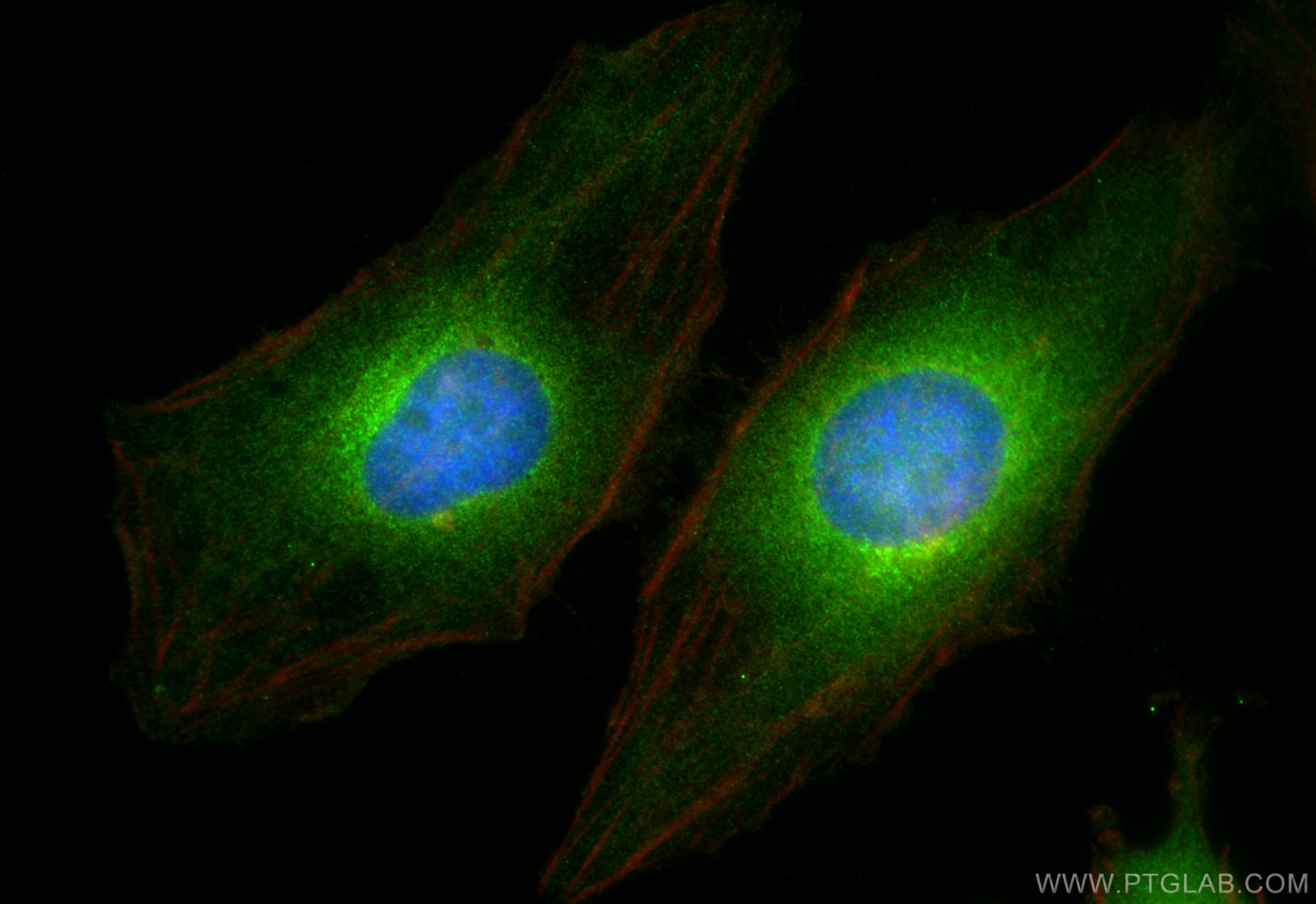 Immunofluorescence (IF) / fluorescent staining of HeLa cells using PELO Polyclonal antibody (10582-1-AP)