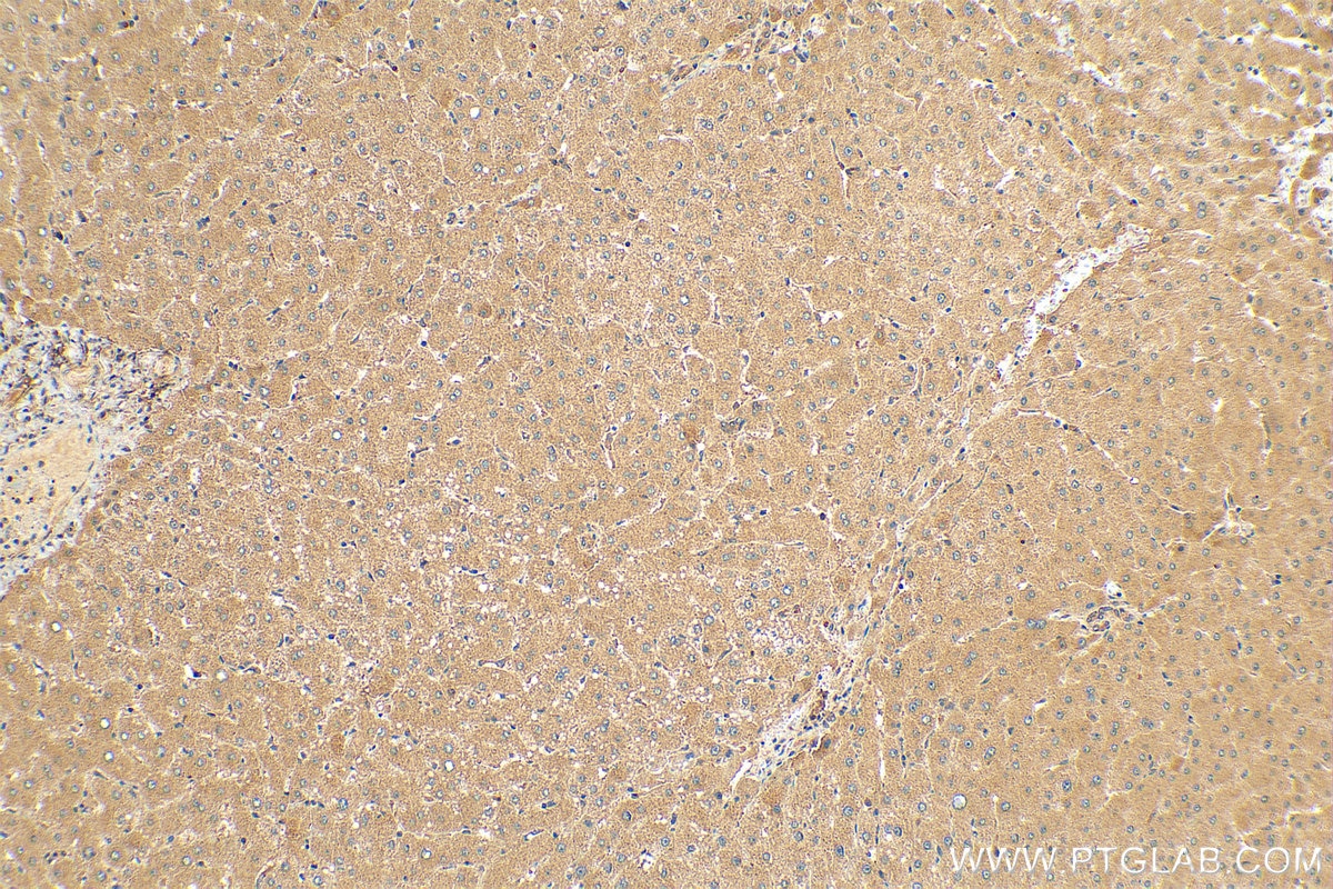 Immunohistochemistry (IHC) staining of human liver tissue using PELO Polyclonal antibody (10582-1-AP)