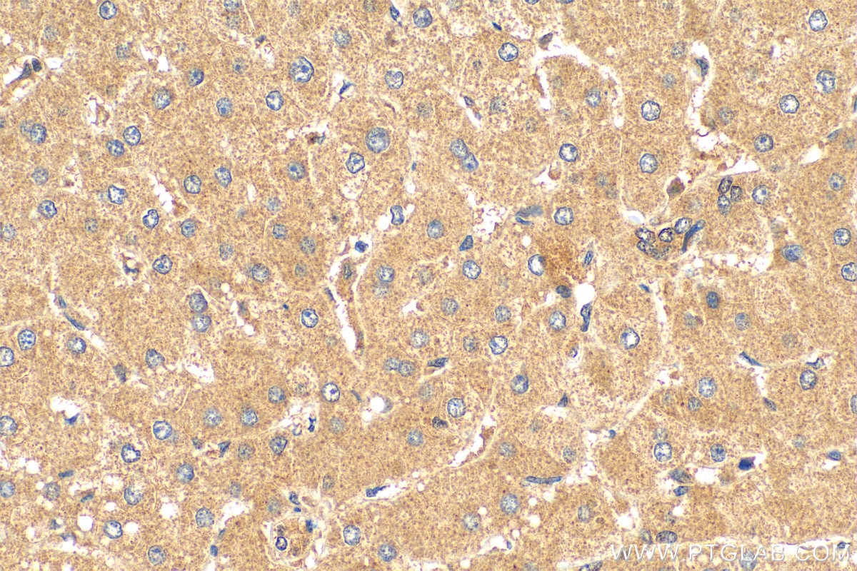 Immunohistochemistry (IHC) staining of human liver tissue using PELO Polyclonal antibody (10582-1-AP)