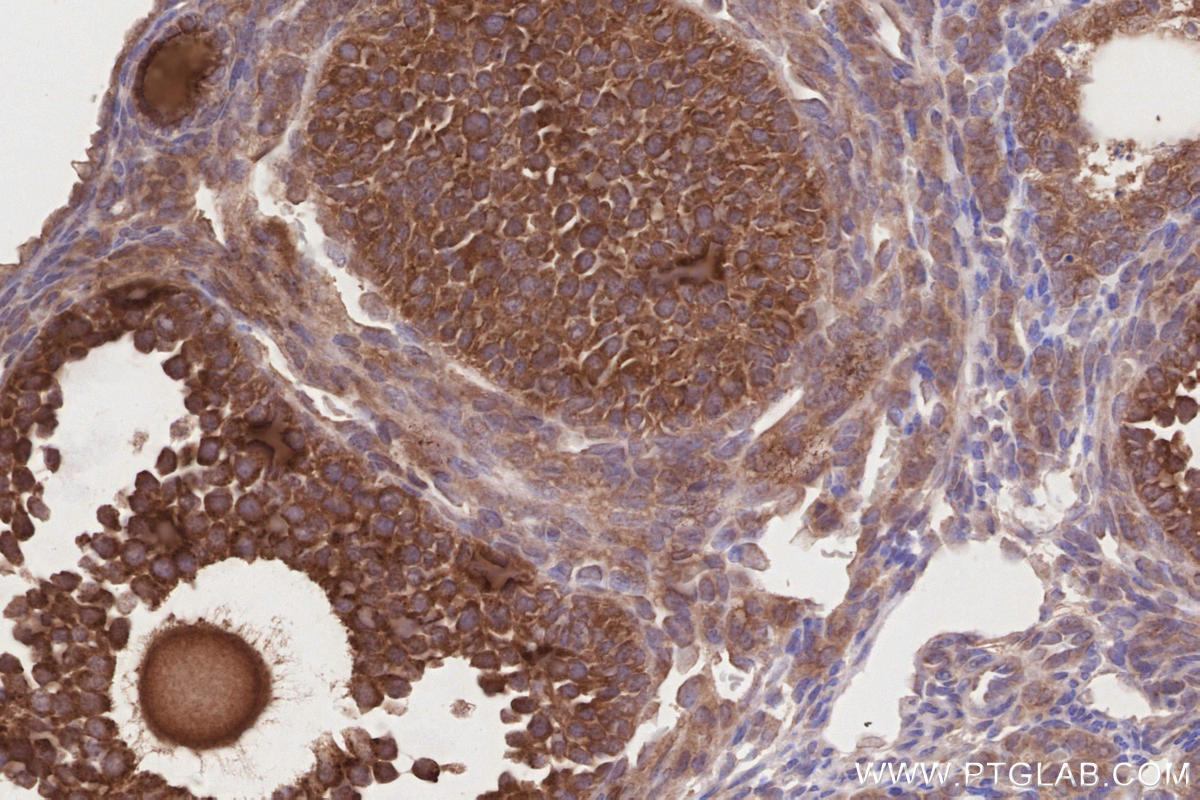 Immunohistochemistry (IHC) staining of mouse ovary tissue using PELO Polyclonal antibody (10582-1-AP)