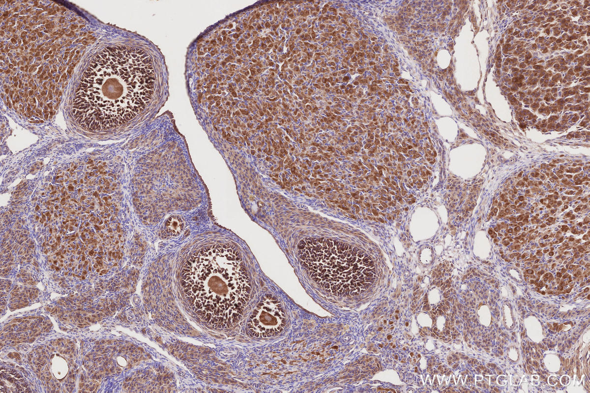 Immunohistochemistry (IHC) staining of rat ovary tissue using PELO Polyclonal antibody (10582-1-AP)