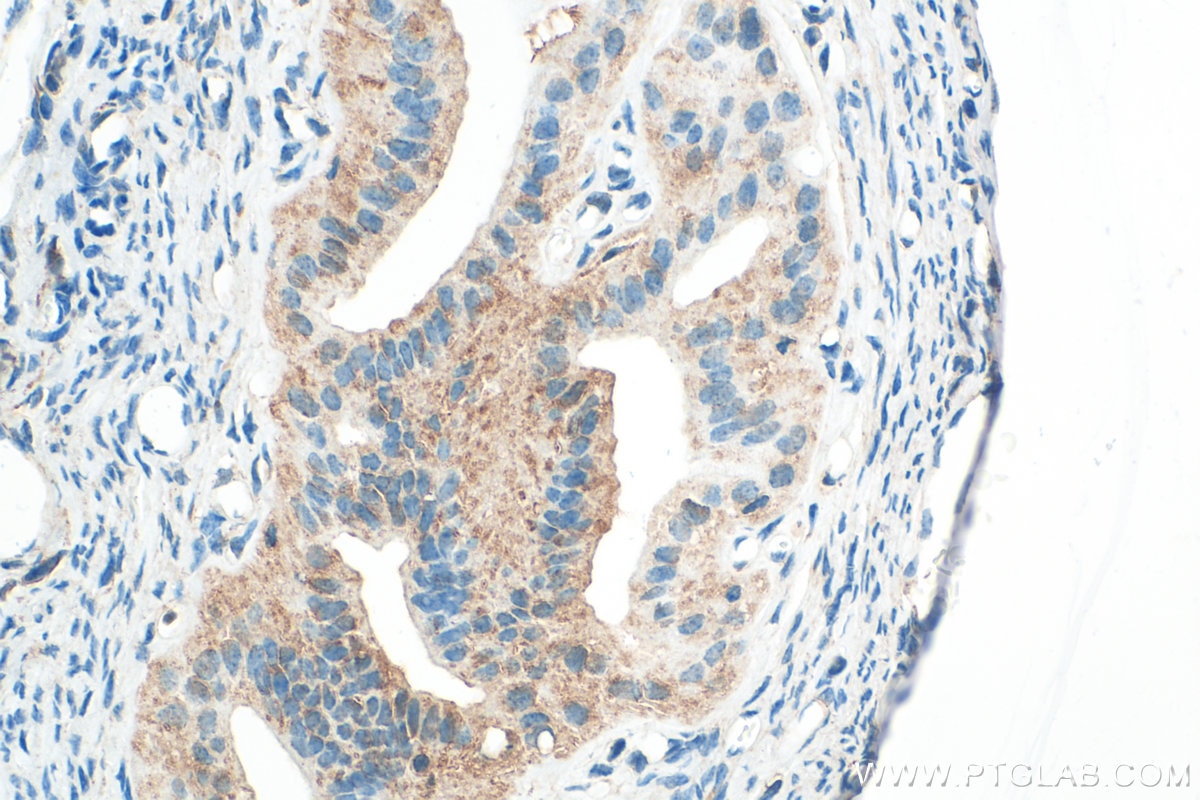 Immunohistochemistry (IHC) staining of mouse ovary tissue using PELO Polyclonal antibody (10582-1-AP)