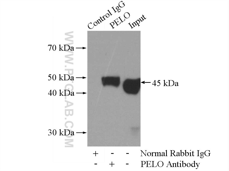 Immunoprecipitation (IP) experiment of HEK-293 cells using PELO Polyclonal antibody (10582-1-AP)