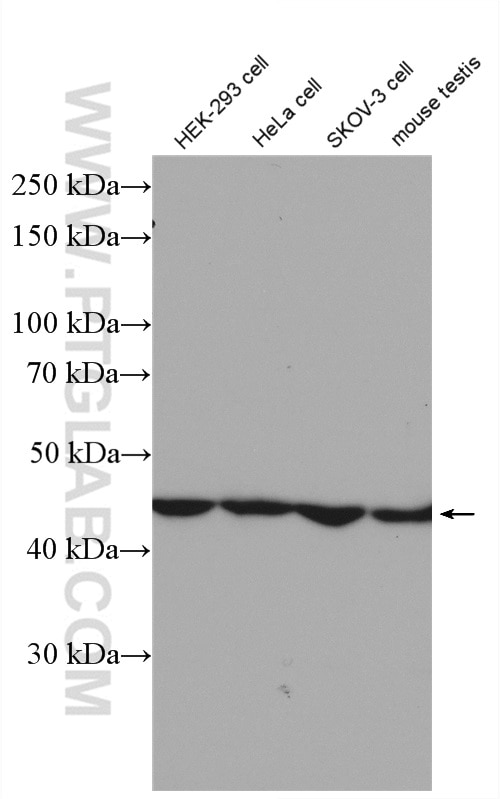 Western Blot (WB) analysis of various lysates using PELO Polyclonal antibody (10582-1-AP)