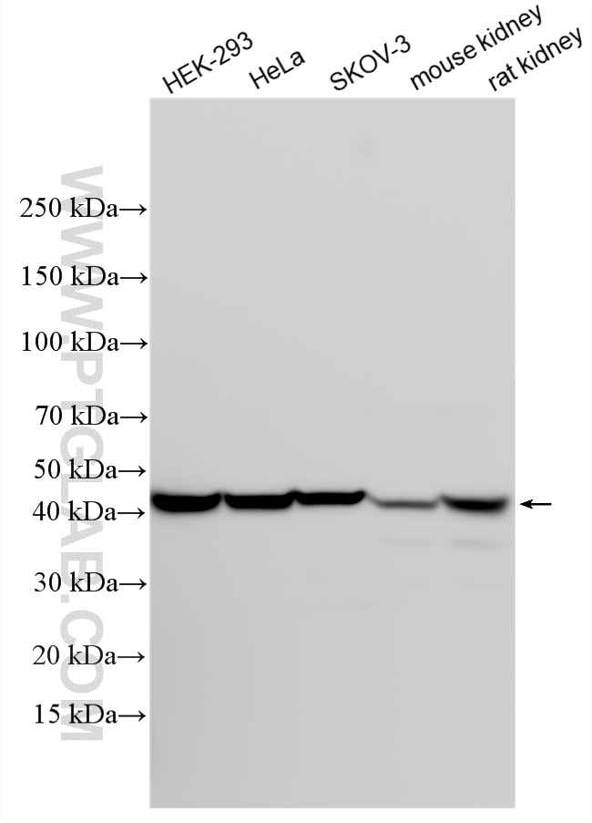 Western Blot (WB) analysis of various lysates using PELO Polyclonal antibody (10582-1-AP)