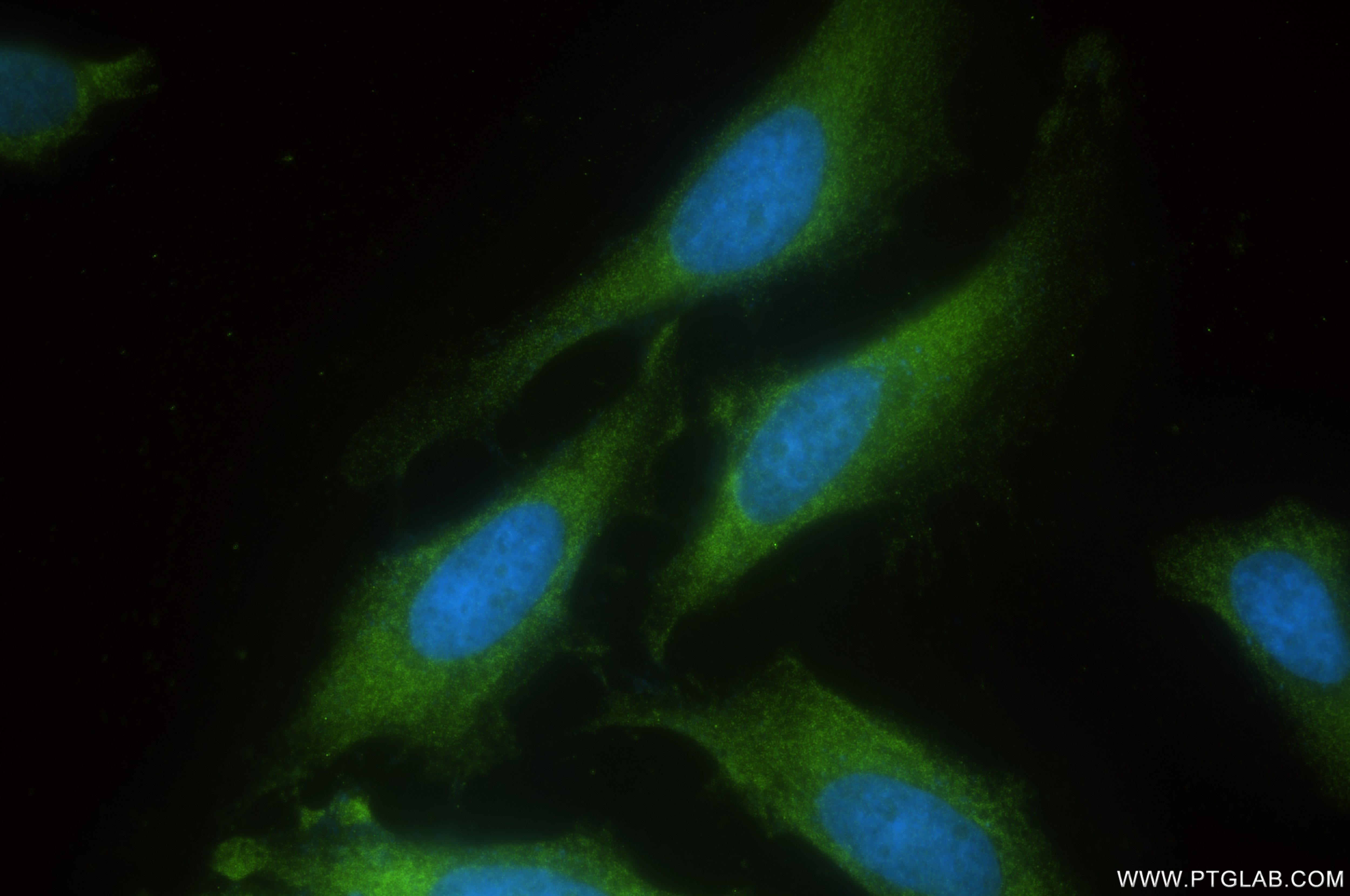 Immunofluorescence (IF) / fluorescent staining of HeLa cells using PELO Recombinant antibody (85743-1-RR)