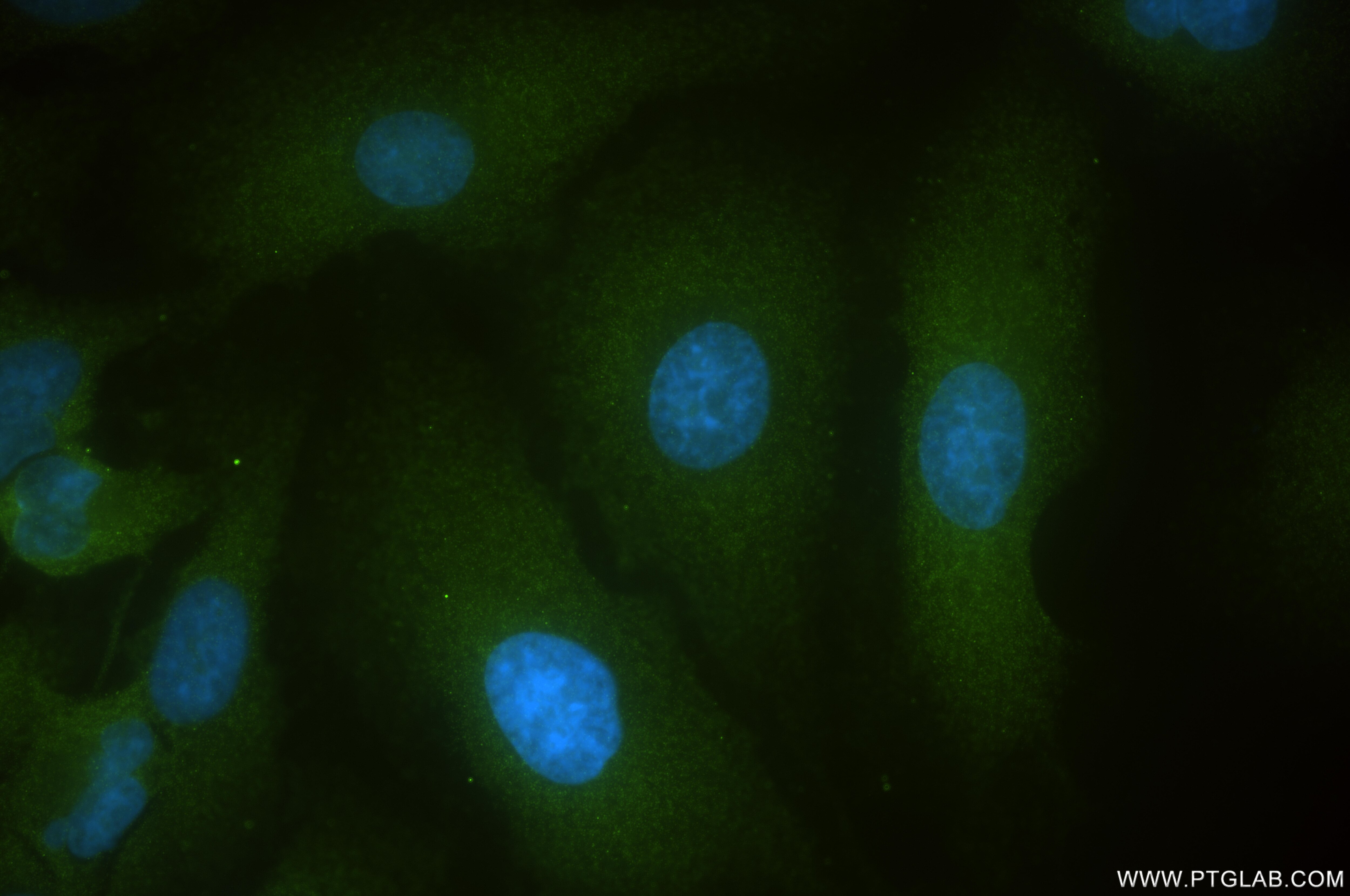 Immunofluorescence (IF) / fluorescent staining of A549 cells using PELO Recombinant antibody (85743-2-RR)