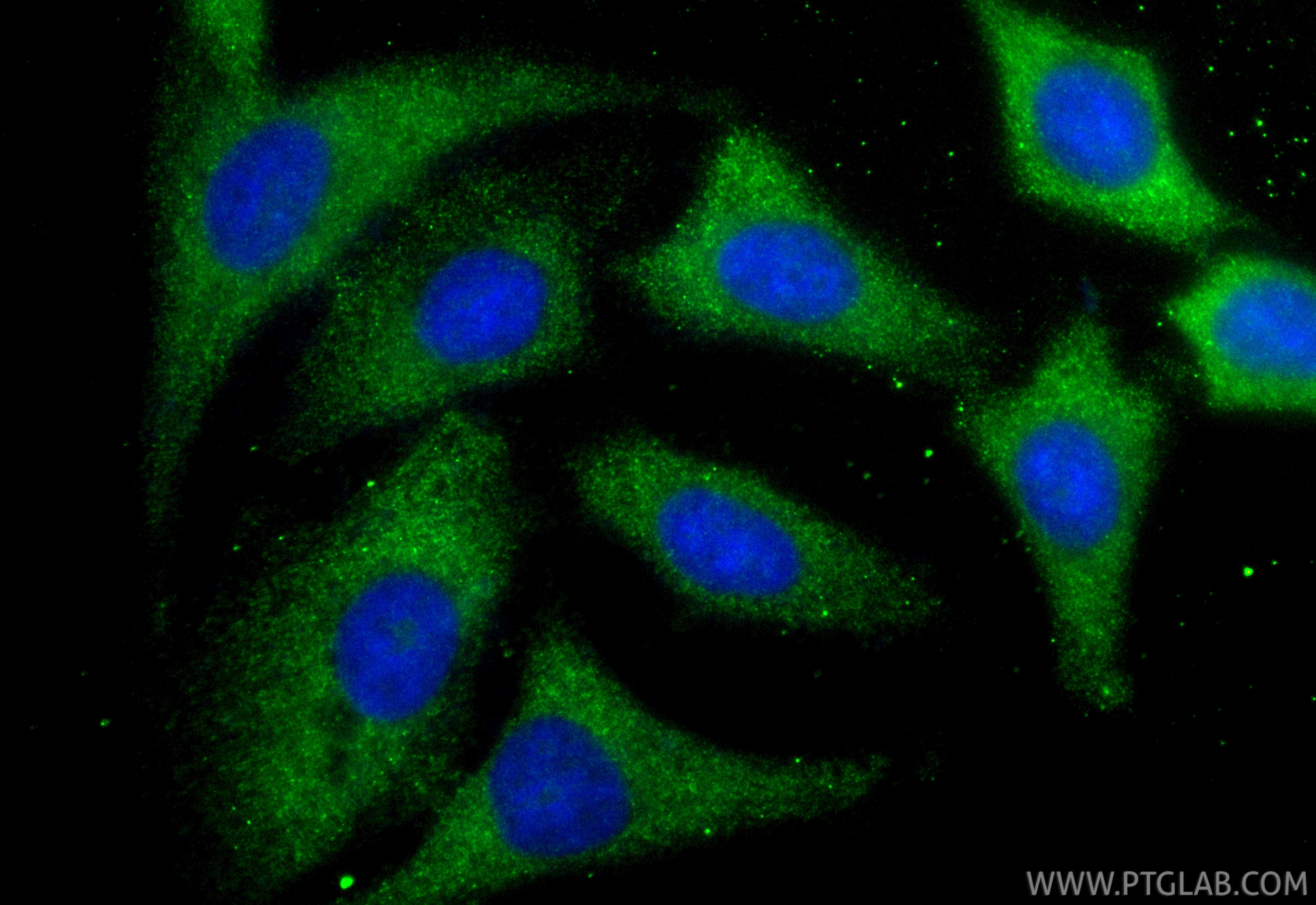 Immunofluorescent analysis of (-20°C Methanol) fixed A549 cells using CoraLite® Plus 488 PELO antibody (CL488-85743, Clone: 243137F4 ) at dilution of 1:200. Immunofluorescence (IF) / fluorescent staining of A549 cells using CoraLite® Plus 488-conjugated PELO Recombinant mon (CL488-85743)
