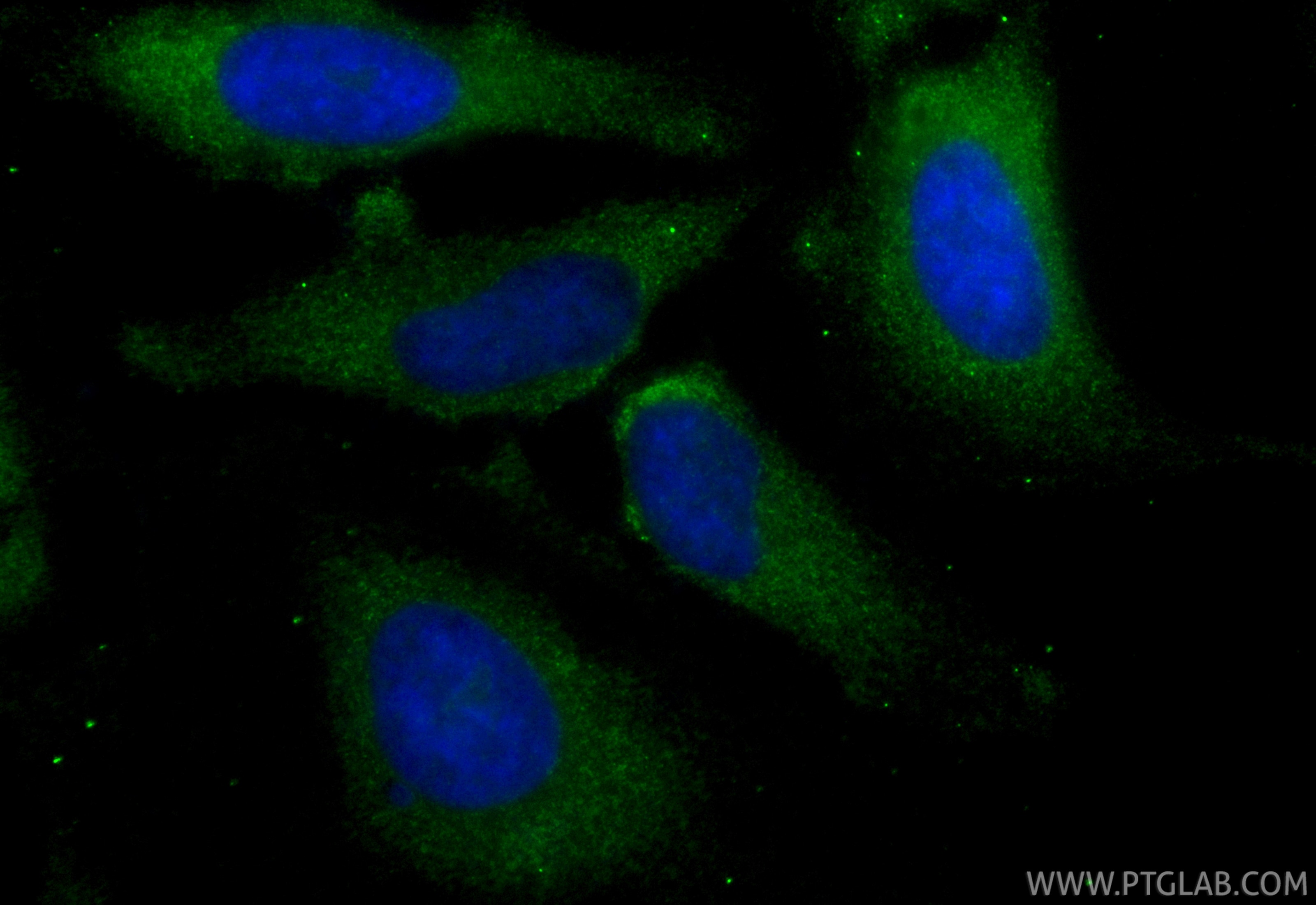 Immunofluorescent analysis of (-20°C Methanol) fixed HeLa cells using CoraLite® Plus 488 PELO antibody (CL488-85743, Clone: 243137F4 ) at dilution of 1:200. Immunofluorescence (IF) / fluorescent staining of HeLa cells using CoraLite® Plus 488-conjugated PELO Recombinant mon (CL488-85743)