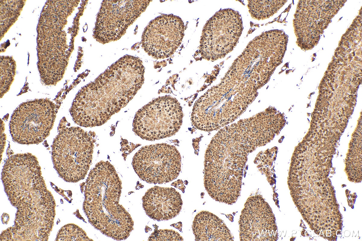 Immunohistochemistry (IHC) staining of mouse testis tissue using PELP1 Polyclonal antibody (30135-1-AP)