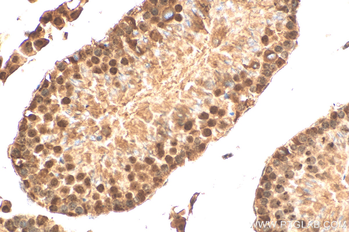 Immunohistochemistry (IHC) staining of mouse testis tissue using PELP1 Polyclonal antibody (30135-1-AP)