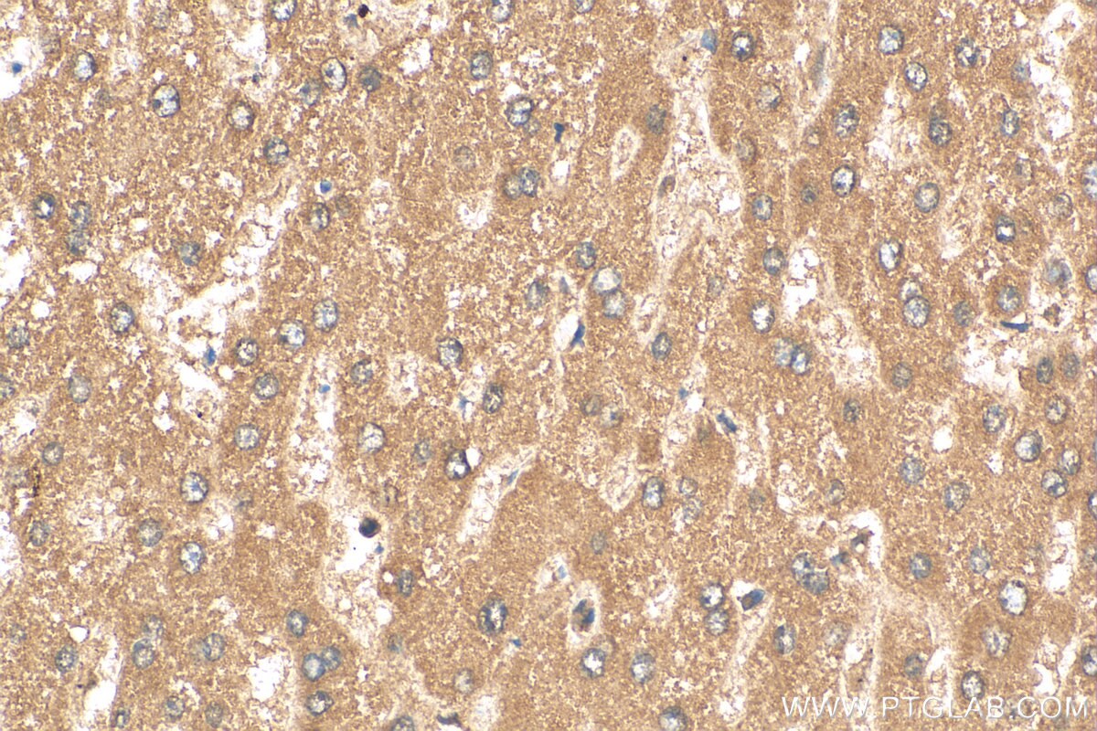 Immunohistochemistry (IHC) staining of human liver tissue using PELP1 Polyclonal antibody (30135-1-AP)
