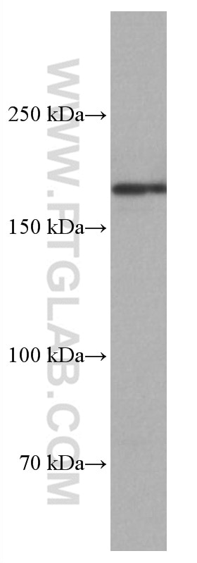 Western Blot (WB) analysis of T-47D cells using PELP1 Monoclonal antibody (67050-1-Ig)