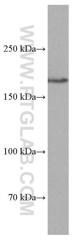 Western Blot (WB) analysis of Jurkat cells using PELP1 Monoclonal antibody (67050-1-Ig)