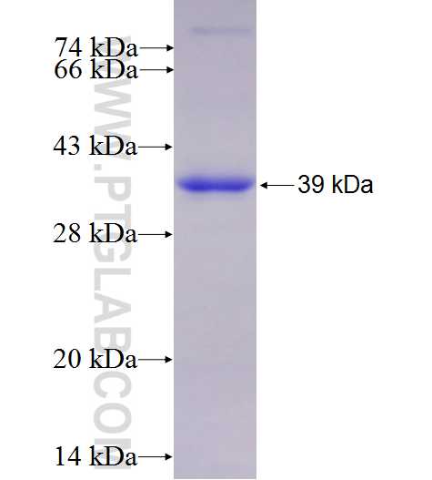 PELP1 fusion protein Ag25729 SDS-PAGE