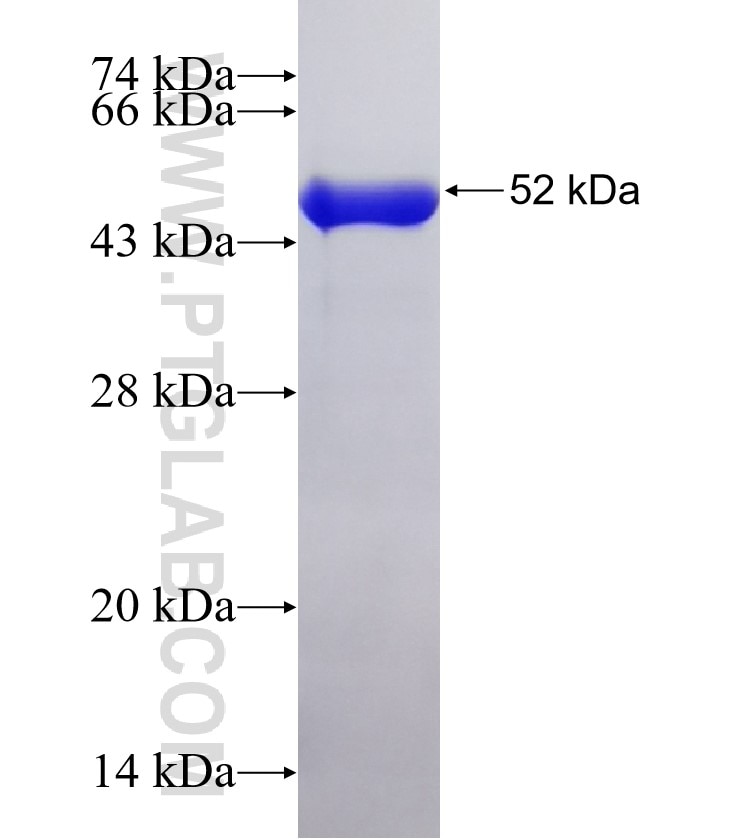 PELP1 fusion protein Ag32720 SDS-PAGE