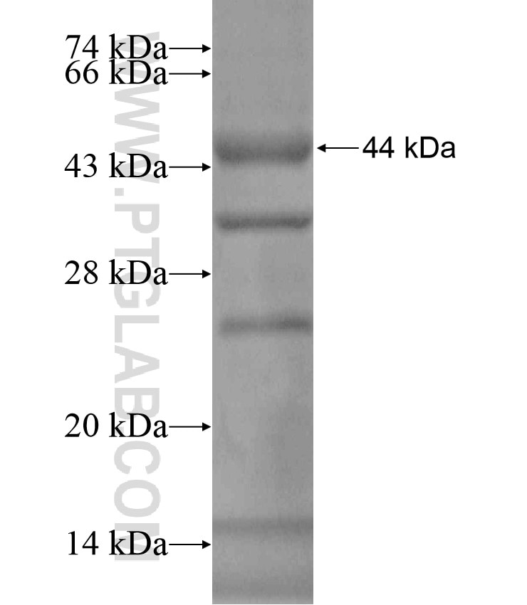 PELP1 fusion protein Ag18087 SDS-PAGE