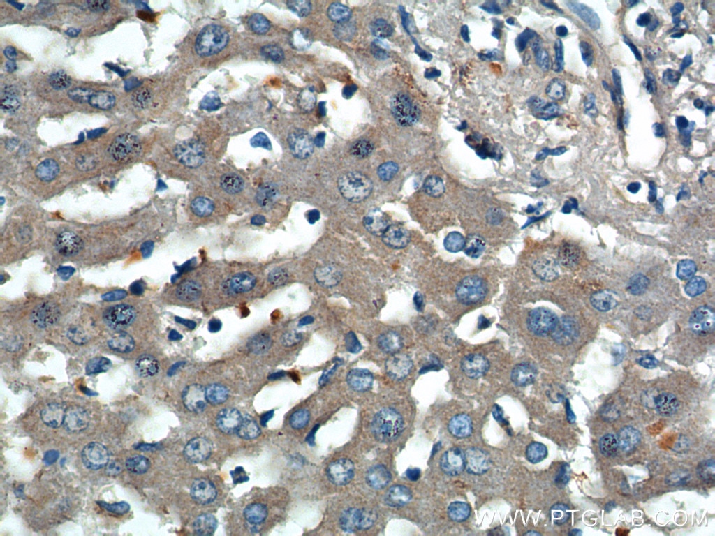 Immunohistochemistry (IHC) staining of human liver tissue using PEMT Polyclonal antibody (25916-1-AP)