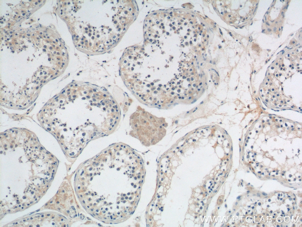 Immunohistochemistry (IHC) staining of human testis tissue using PEMT Polyclonal antibody (25916-1-AP)