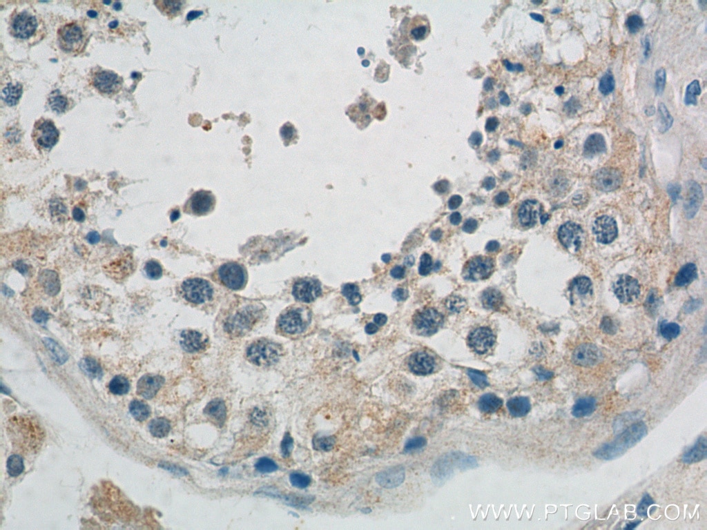 Immunohistochemistry (IHC) staining of human testis tissue using PEMT Polyclonal antibody (25916-1-AP)
