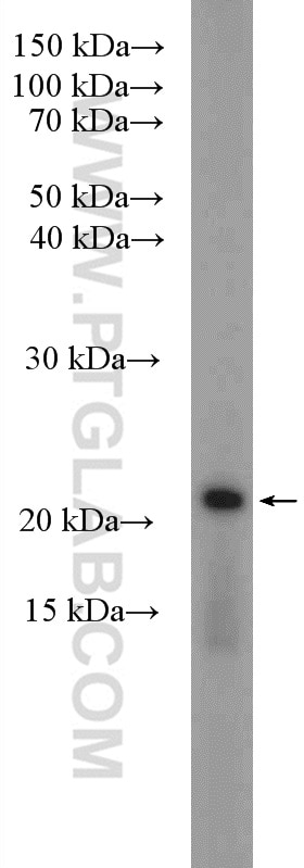 Western Blot (WB) analysis of mouse liver tissue using PEMT Polyclonal antibody (25916-1-AP)