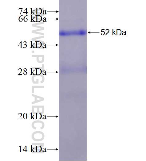 PEMT fusion protein Ag8034 SDS-PAGE
