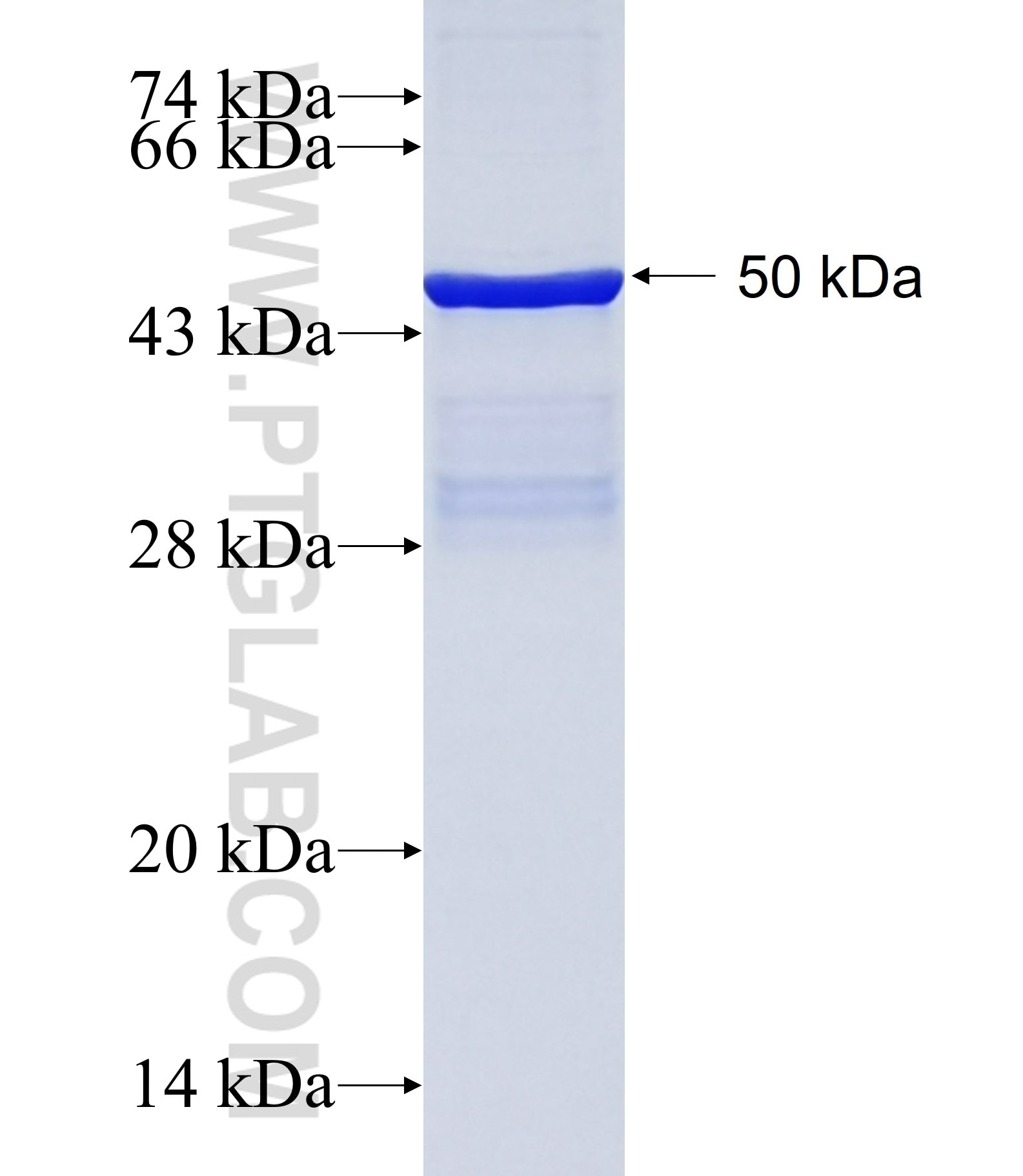 PEMT fusion protein Ag8034 SDS-PAGE