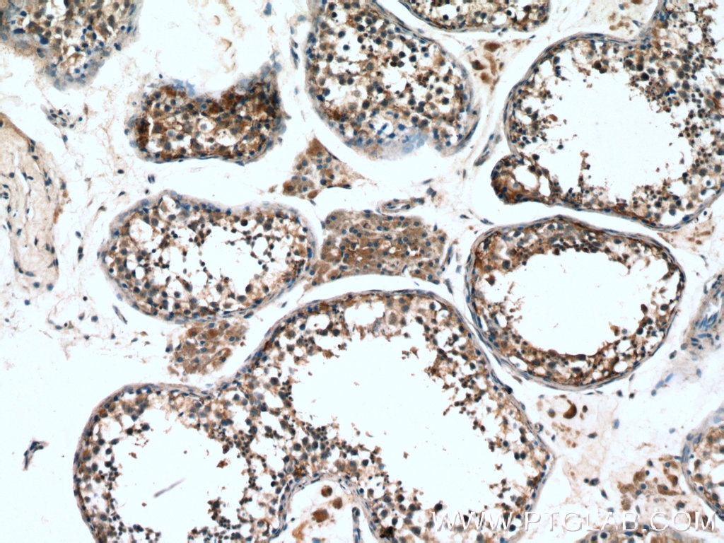 Immunohistochemistry (IHC) staining of human testis tissue using Proenkephalin-A Polyclonal antibody (13531-1-AP)
