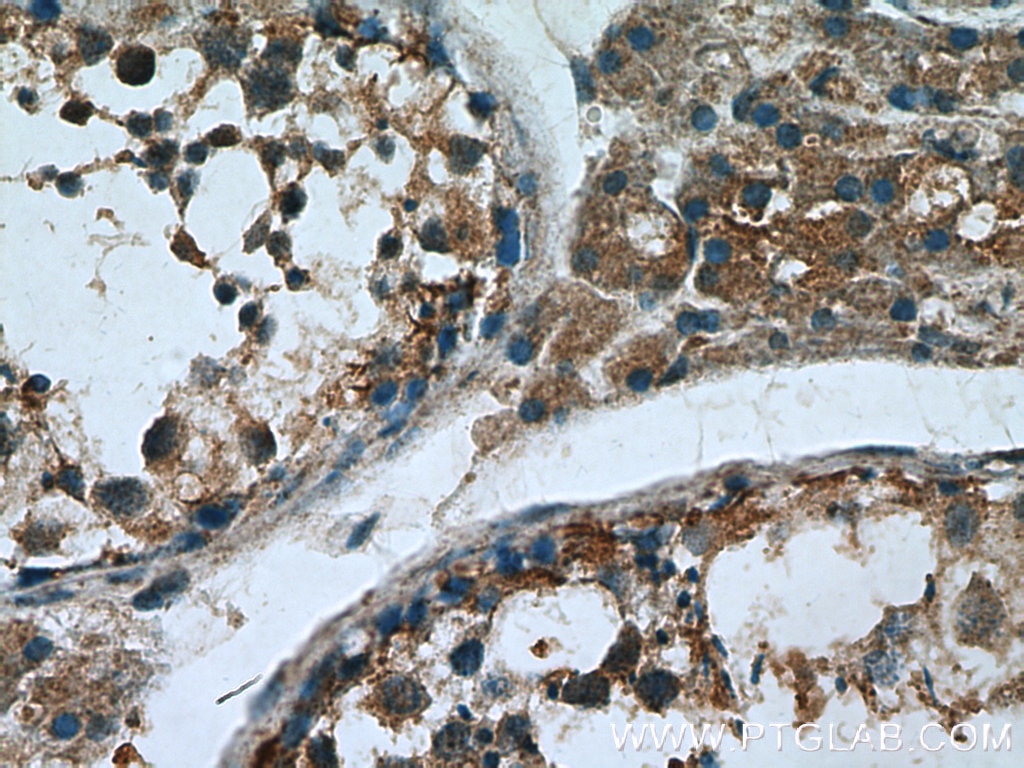 Immunohistochemistry (IHC) staining of human testis tissue using Proenkephalin-A Polyclonal antibody (13531-1-AP)