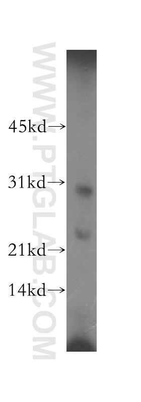 Proenkephalin-A