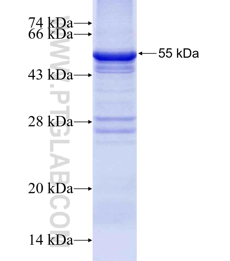 PENK fusion protein Ag4428 SDS-PAGE