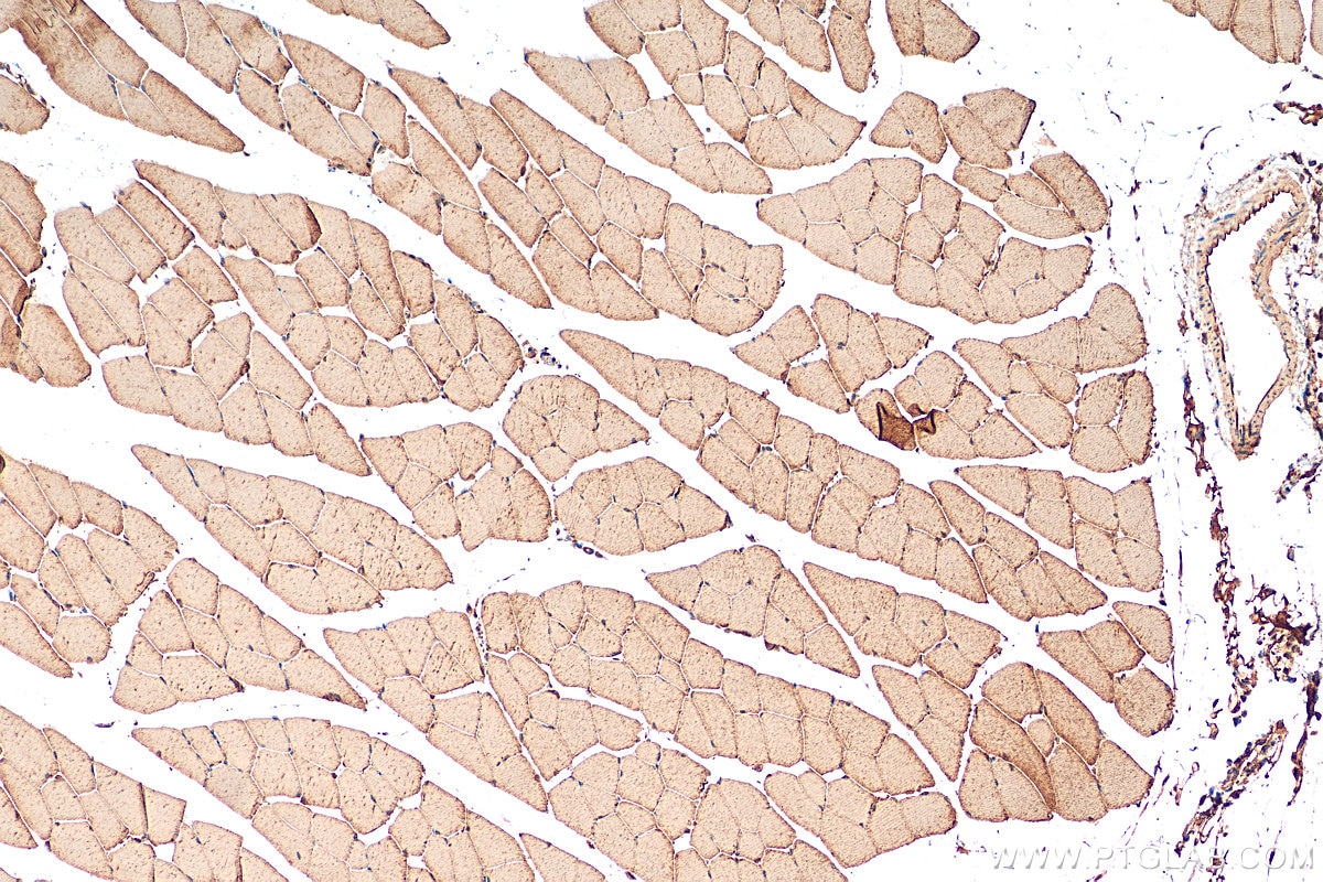 Immunohistochemistry (IHC) staining of mouse skeletal muscle tissue using Twinkle/PEO1 Polyclonal antibody (13435-1-AP)