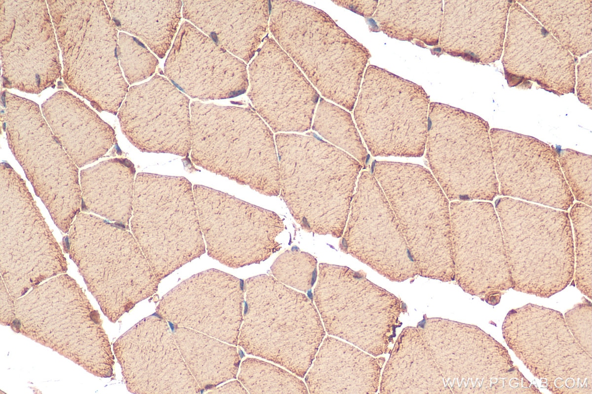 IHC staining of mouse skeletal muscle using 13435-1-AP