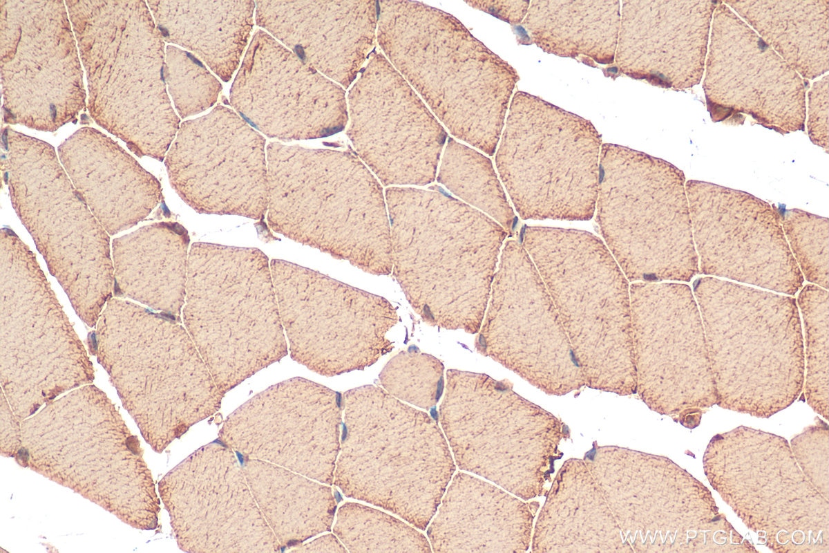 Immunohistochemistry (IHC) staining of mouse skeletal muscle tissue using Twinkle/PEO1 Polyclonal antibody (13435-1-AP)