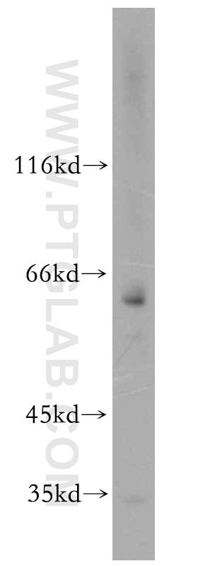 Western Blot (WB) analysis of HeLa cells using Twinkle/PEO1 Polyclonal antibody (13435-1-AP)