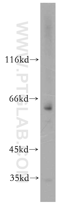 WB analysis of HeLa using 13435-1-AP