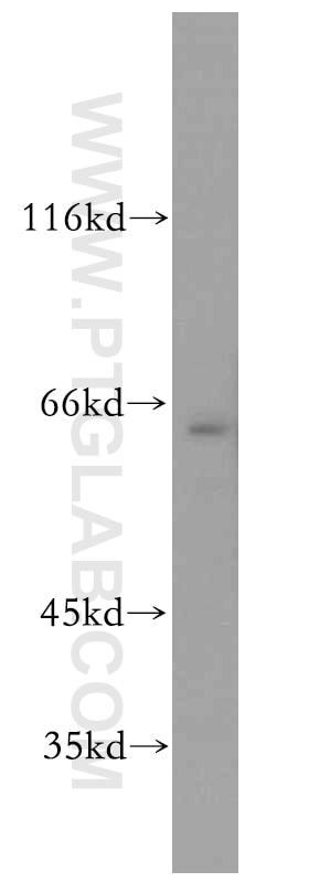 Western Blot (WB) analysis of Jurkat cells using Twinkle/PEO1 Polyclonal antibody (13435-1-AP)