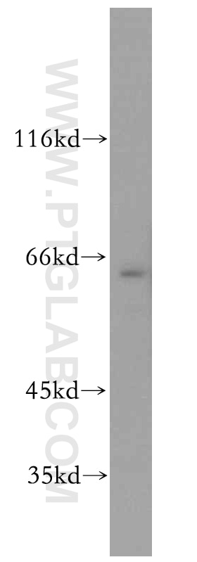 Western Blot (WB) analysis of Jurkat cells using Twinkle/PEO1 Polyclonal antibody (13435-1-AP)