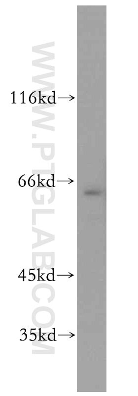 WB analysis of Jurkat using 13435-1-AP