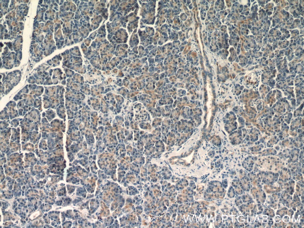 IHC staining of human pancreas using 18793-1-AP