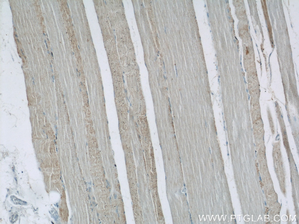 IHC staining of human skeletal muscle using 18793-1-AP