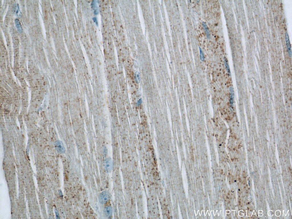 Immunohistochemistry (IHC) staining of human skeletal muscle tissue using Twinkle/PEO1 Polyclonal antibody (18793-1-AP)